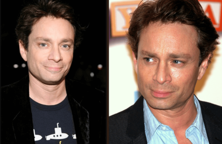Chris Kattan